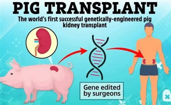 创异种移植新纪录!美国男子体内移植猪肾生存271天_wishdown.com 创异种移植新纪录!美国男子体内移植猪肾生存271天_wishdown.com