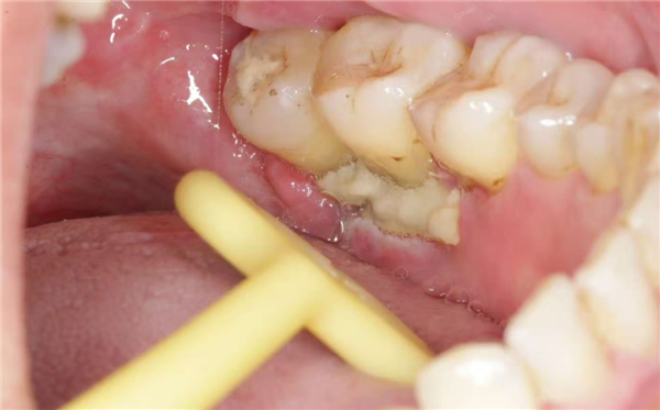 这件多数人不重视的小事 关键时刻可能把癌症治疗拖垮_wishdown.com 这件多数人不重视的小事 关键时刻可能把癌症治疗拖垮_wishdown.com