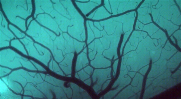 1.5秒植入!马斯克脑机接口公司技术新突破 超万人等待上脑_wishdown.com 1.5秒植入!马斯克脑机接口公司技术新突破 超万人等待上脑_wishdown.com