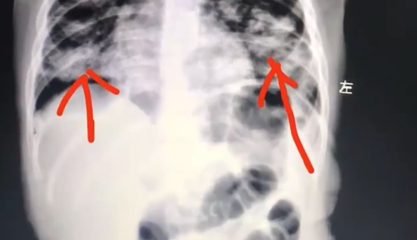 1�걦����ʳ�ϲ��Ͳ�Σ����������ֿٴ��� ����ȫ��