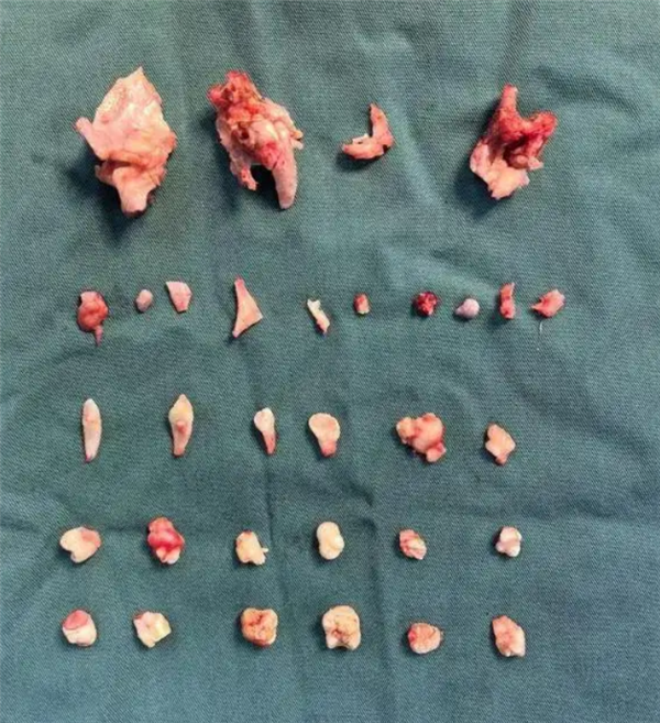 18����Ů���ٺ�ʹ��ֹ���ָ����׿� ר�ң���̥�� ������24������