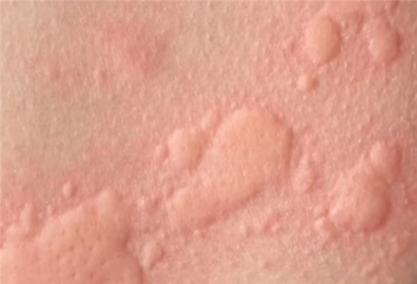 �������ֶ�ֻ�ܿ�ҩ�ﻺ�� ȫ���������������鷴��