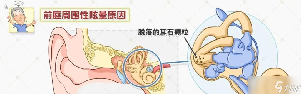 ��Խ������Ϸ����ͷ�ε�ԭ����ʲô ��ô������Ϸѣ��