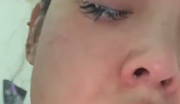 Ů����502�������н�ëȫ���� ��ҽ��ס����