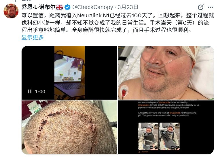 英国退伍军人使用脑机接口玩《魔兽世界》_wishdown.com 英国退伍军人使用脑机接口玩《魔兽世界》_wishdown.com