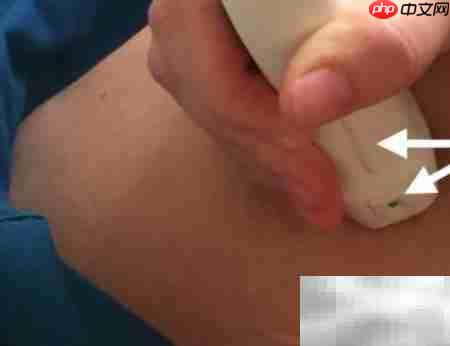 超声探头使用指南_wishdown.com 超声探头使用指南