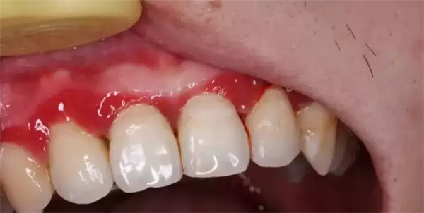 һ�ֻ������ݵ���Ĳ� �ܶ�������ʱ������