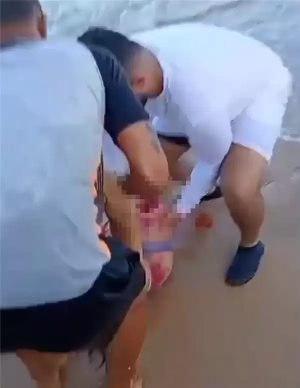 巴西19岁女子海边游玩时遭鲨鱼袭击:救上岸时已被咬断一条腿_wishdown.com 巴西19岁女子海边游玩时遭鲨鱼袭击:救上岸时已被咬断一条腿_wishdown.com