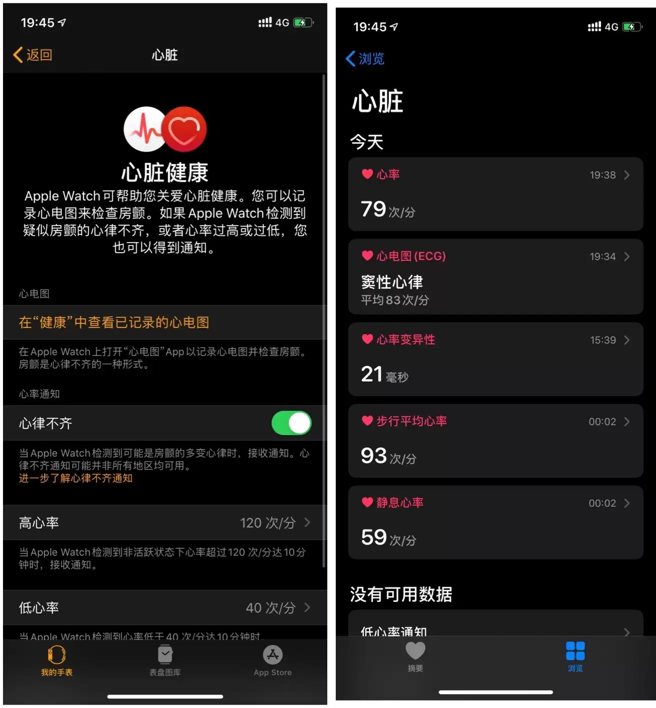 ���� Apple Watch ��ͨ ECG ���ܷ���